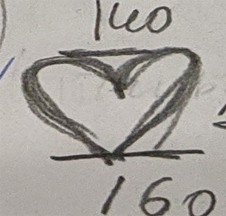 Межъярус "Сердце" Межъярус "Сердце"